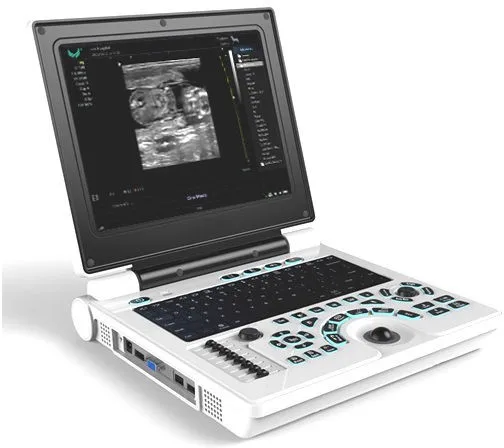 New launch P20 laptop B/W ultrasound scanner with PW/ IMT function