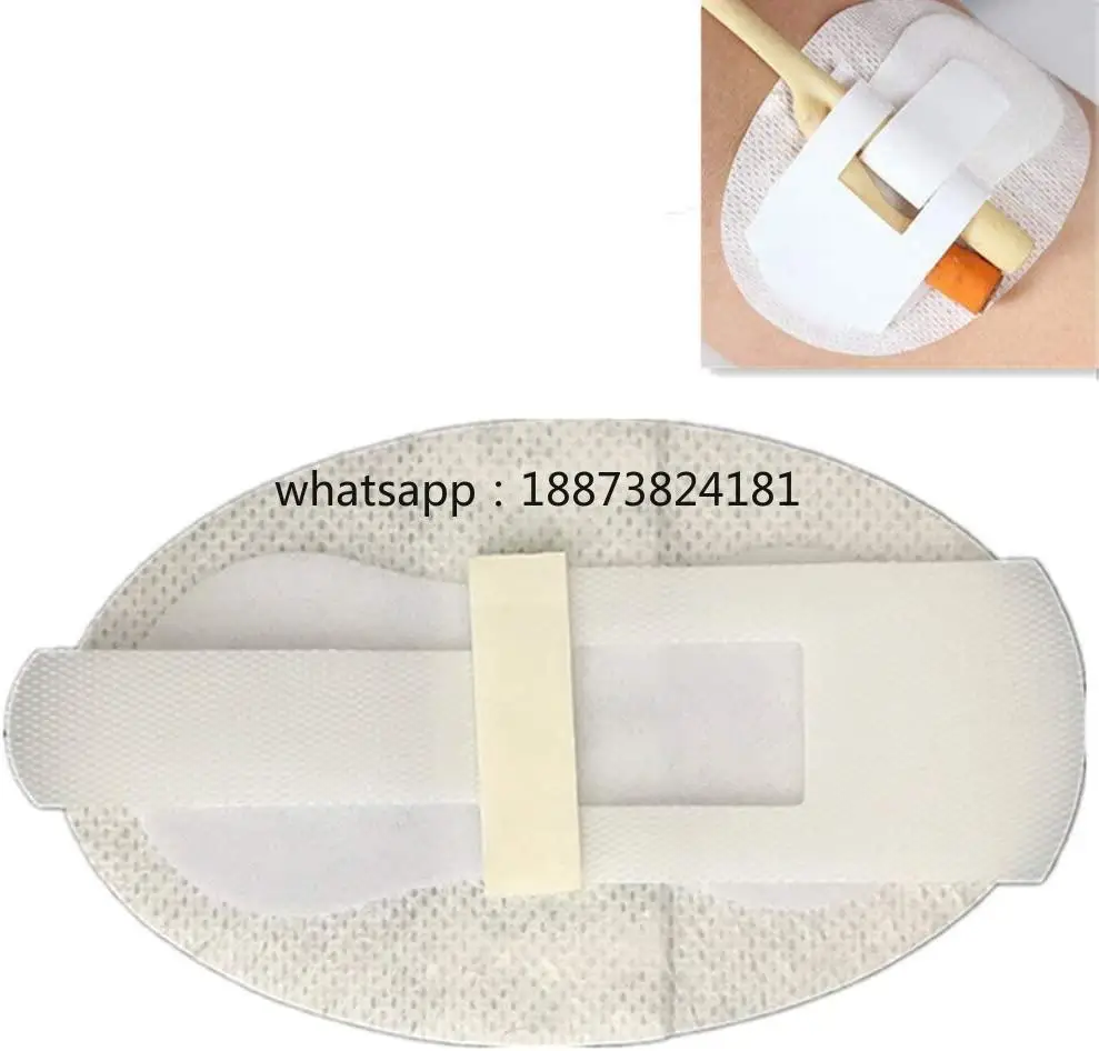 Medical Body Surface Tube Catheter Fixation Clinical Surgical Disposable Catheter Fixing  fast shipping
