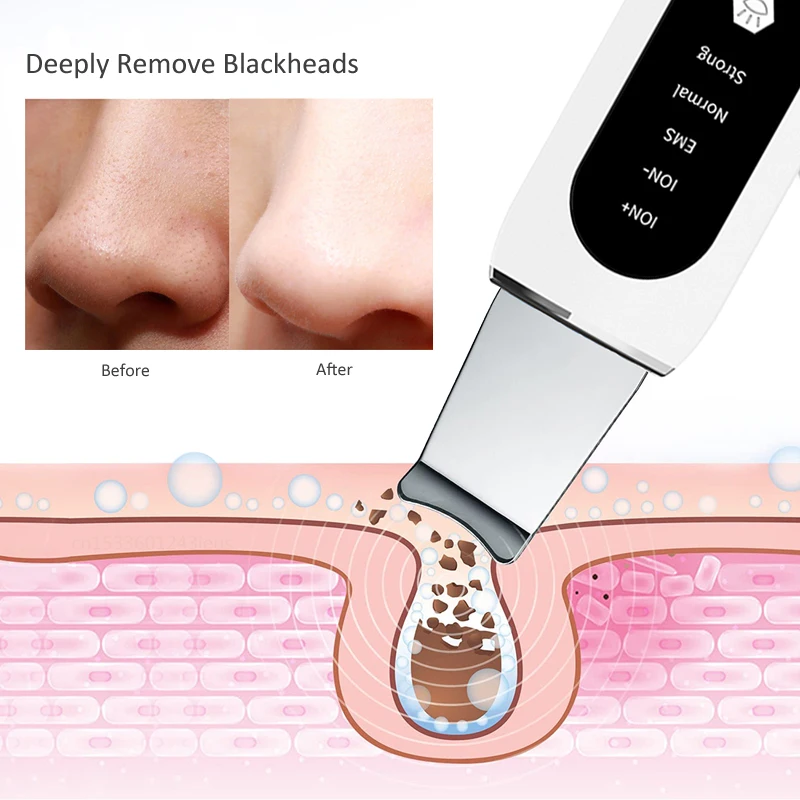 Deep Face Cleaning Ultrasonic Skin Scrubber Vibration Spatula for Skin Care Peeling Facial Blackhead Pore Cleaner Shovel Lifting