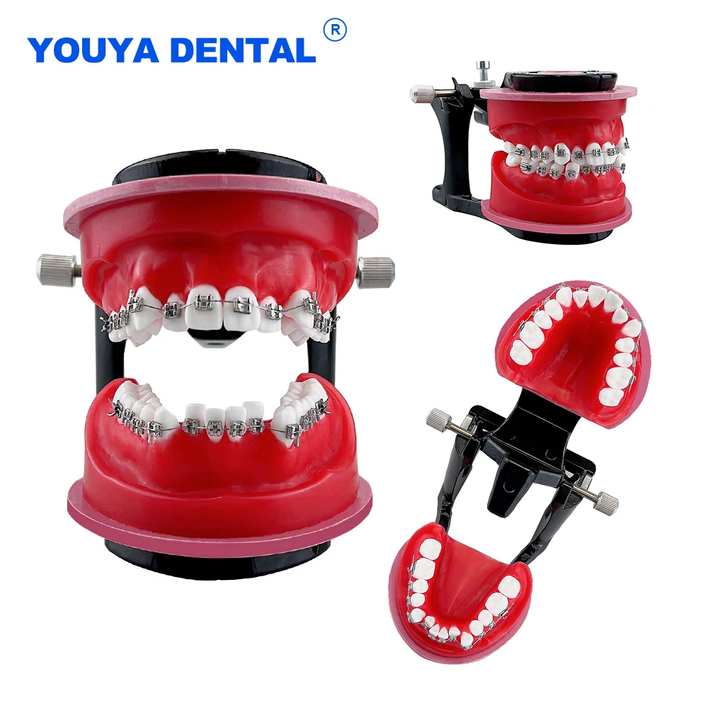 Dental Orthodontic Teeth Practice Model Red Wax Gum Tooth Metal Brackets Ligature Ties Teaching Study Communication Dentist