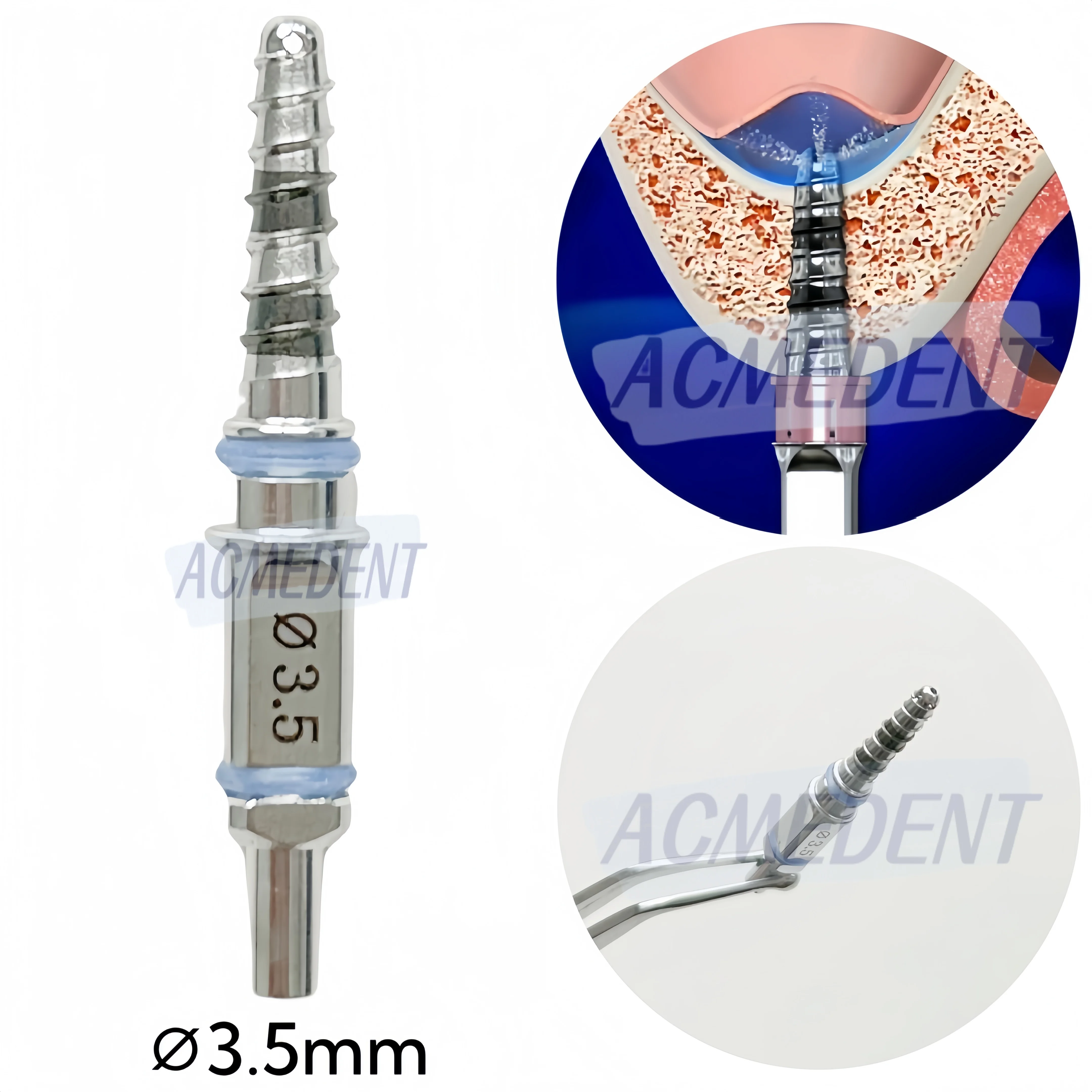 ∅3.5 Dental Water Rising Drill 5 Holes WRS Hydraulic Membrane Lifter Sinus Lift Dome Water Rising System 1-10pcs