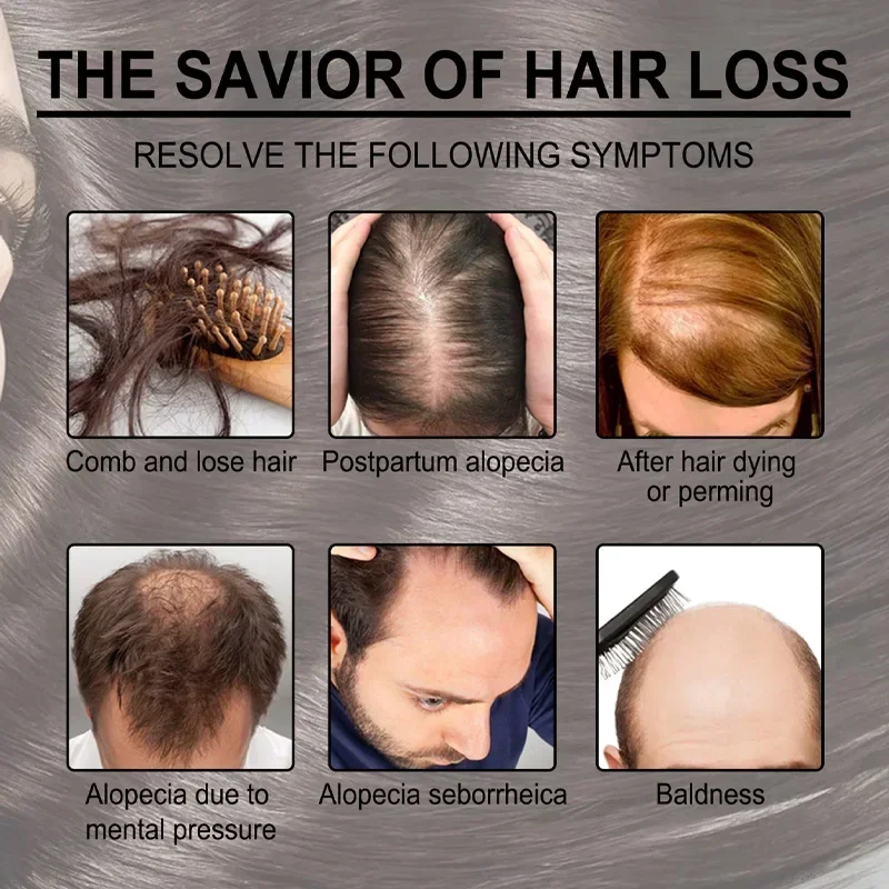 

Капсула для роста волос — восстанавливает поврежденные, питательные процедуры, способствует быстрому росту волос и предотвращает выпадение волос.