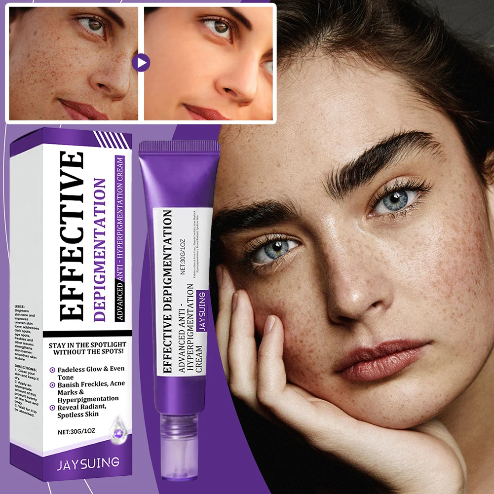 

30g Advanced Pigmentation Reducing Cream Spot Off Freckle Whitening Cream Soothing Rejuvenating Skin Solution Face Care Supplies