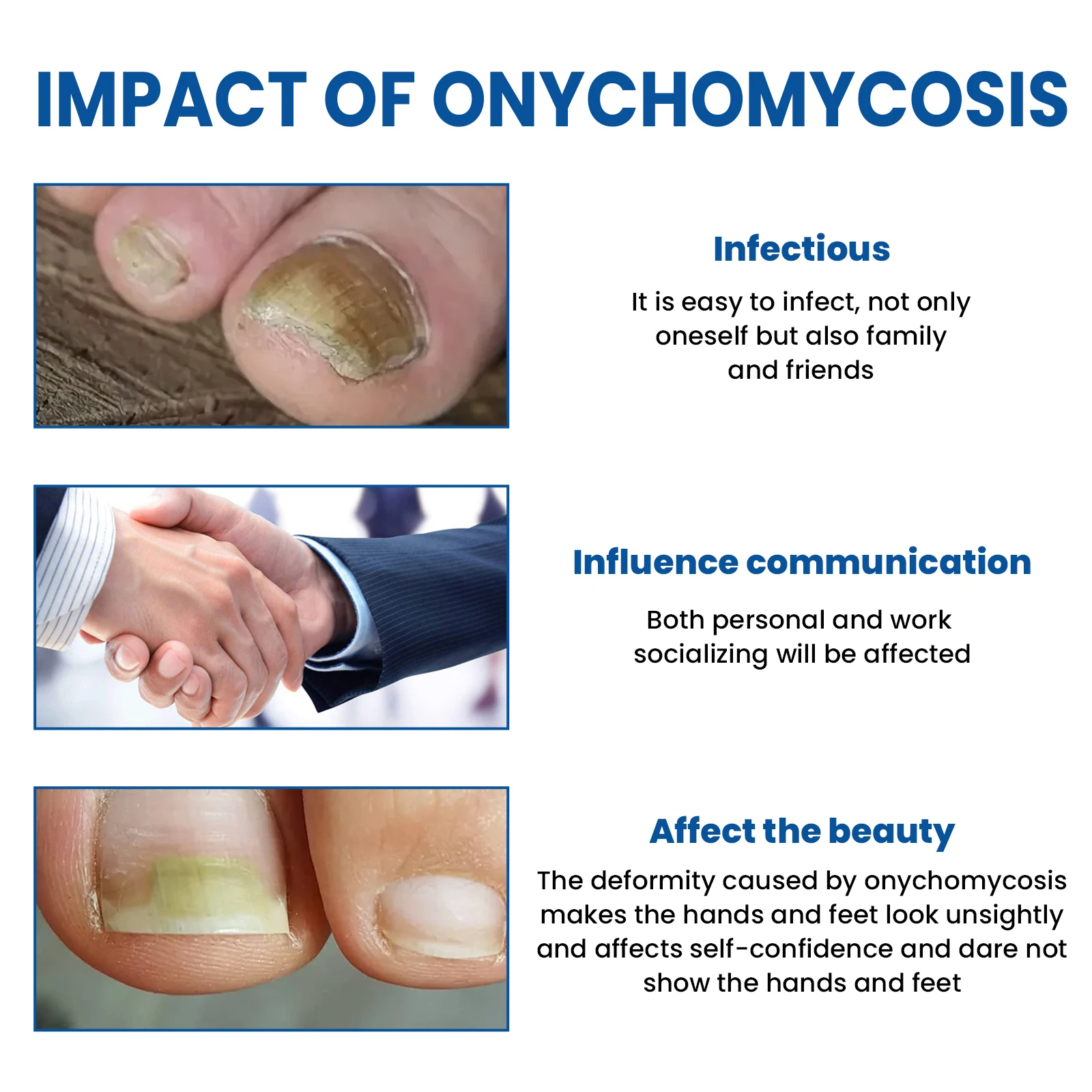 30ml Nail Fungus Repairing Liquid Soothes Softens Moisturizes Nails Deeply Clean Repairs Restores Nail Luster Essential Oils