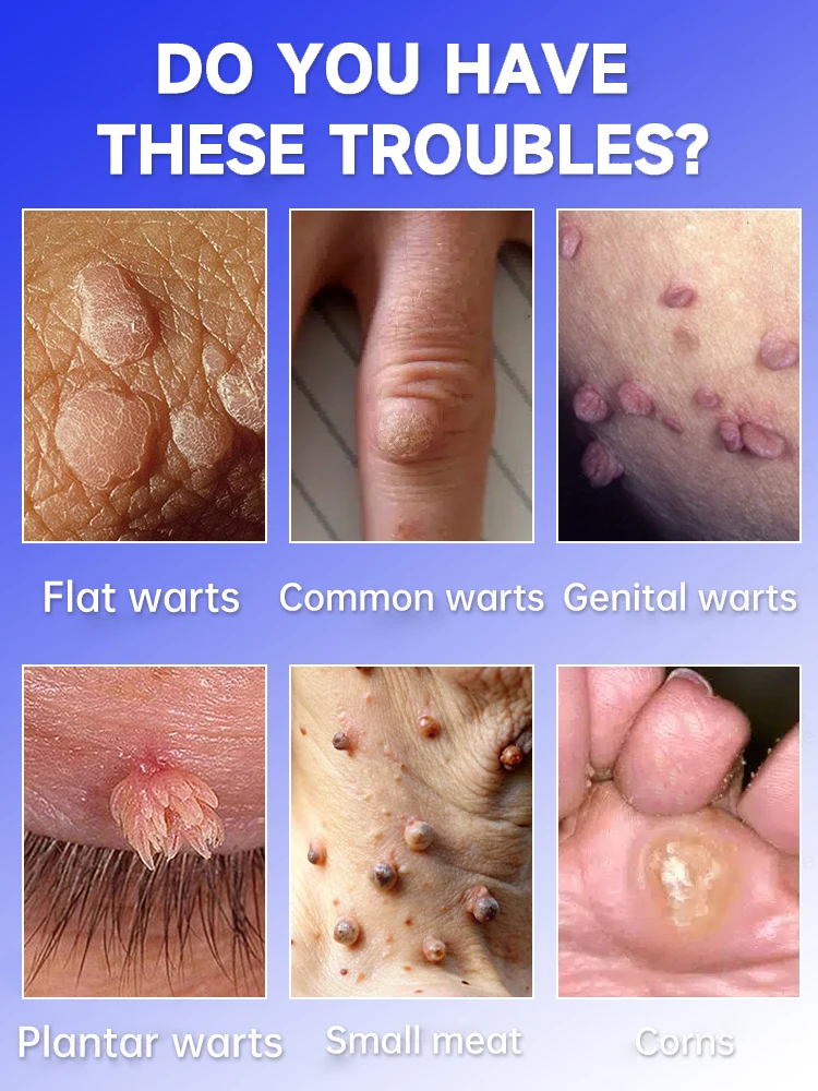 

solve skin problems only 7 days