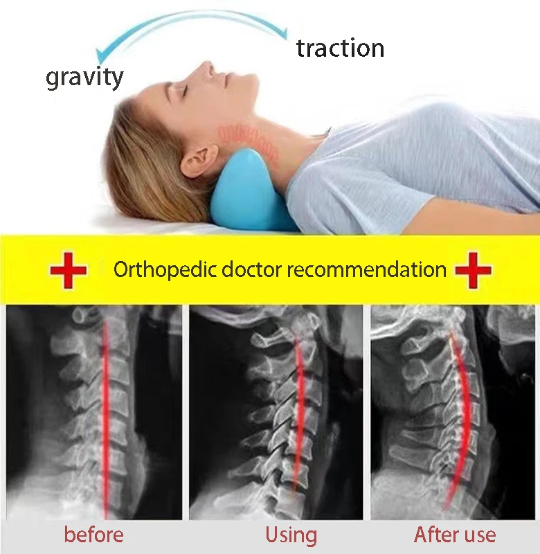 Corrector de joroba de cuello, almohada relajante para aliviar el dolor de cuello, artefacto de corrección especial para dormir, almohada de