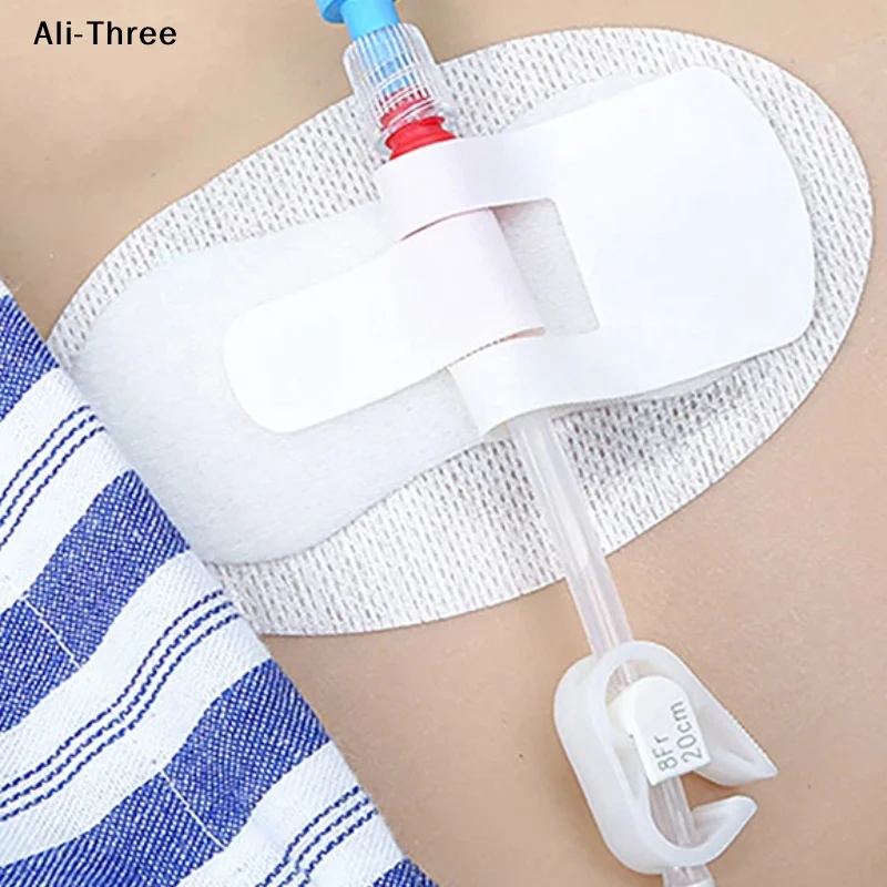 

Крепление для катетера, фиксатор трубки, лента для уретрального катетера, самоклеящийся бандаж для стабилизации нефростомы, устройство для фиксации мочи, анкер для стабилизации G-образного катетера