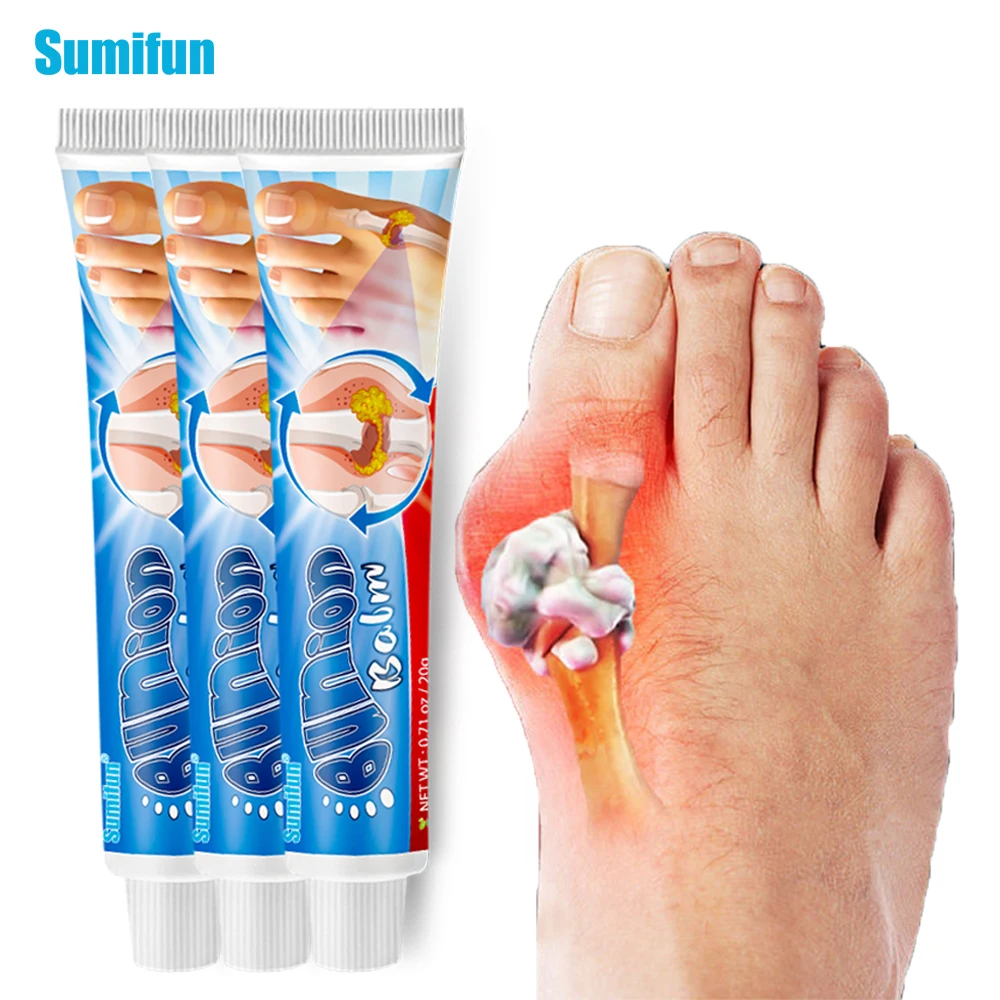 

1/2/3Pcs Sumifun Gout Treatment Ointment Hallux Valgus Bunion Toe Swelling Pain Relief Ointment Joint Arthritis Medical Plaster