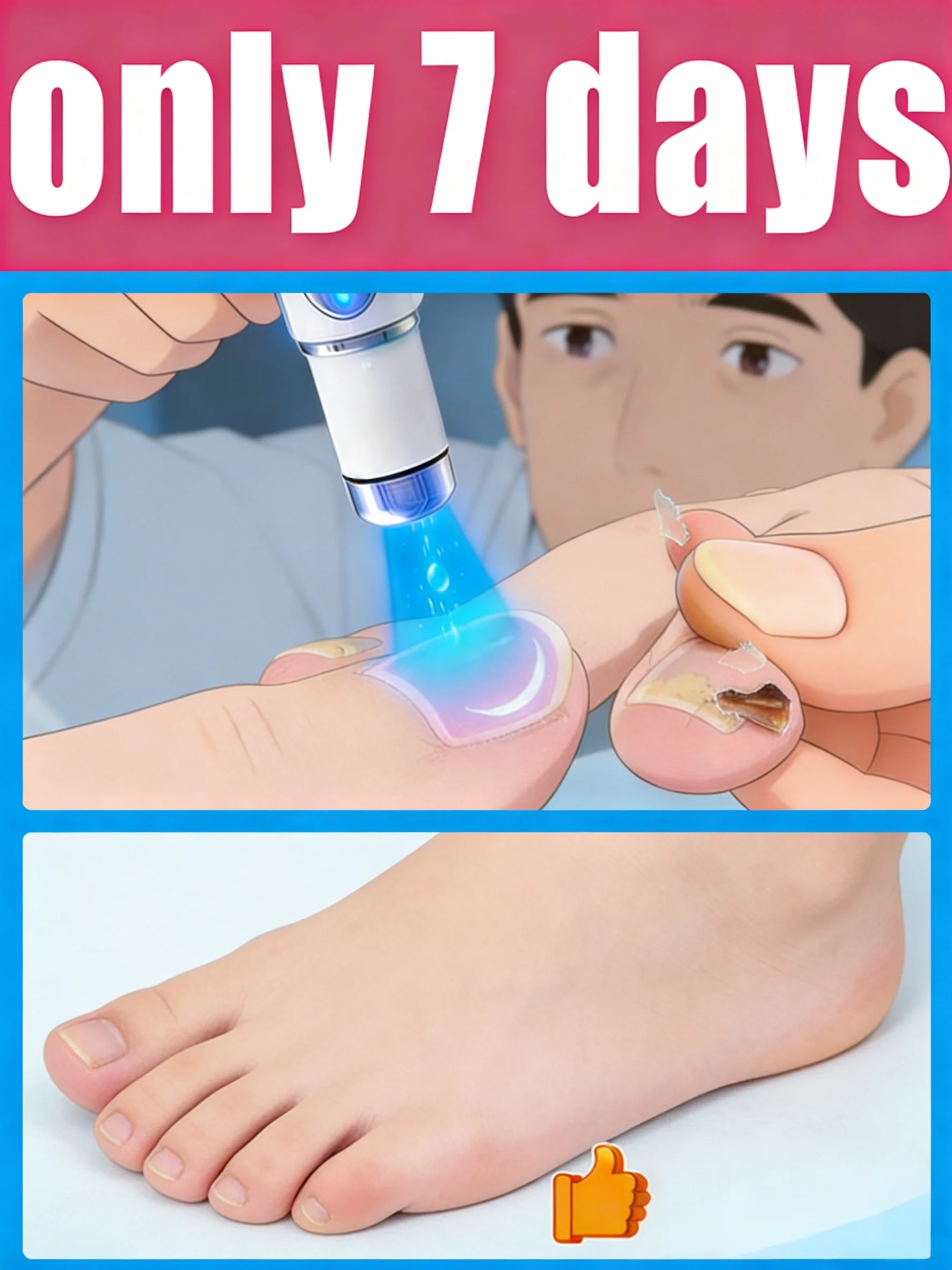 

Outil Wart Blue Light, plus de réductions sur les ensembles