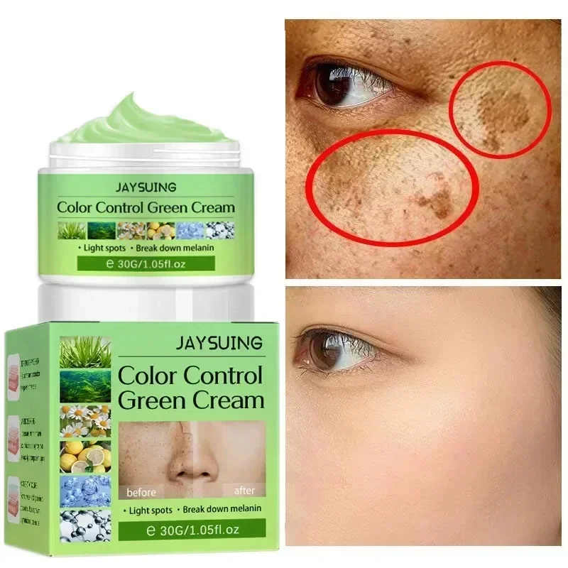 

Powerful Spot-removing Whiten Cream Brighten Skin Fast Eliminates Melanin Pigmentation Melasma Dark Spots Moisturize Beauty Gel