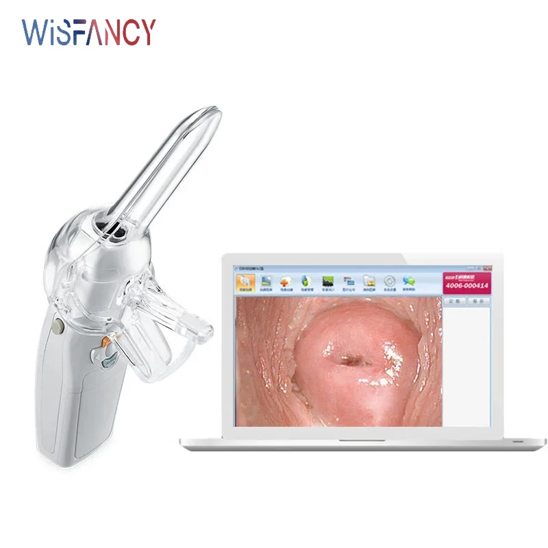 Mini Colposcope Vaginal Endoscope Colposcopy Portable Digital Video Electronic Self-exam Speculum Mirror for Hospital Clinic USB