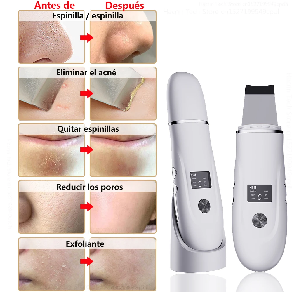 Ultrasonic Peeling Remover Blackhead Facial Skin Scrubber Facial Shovel Deep Cleaning Face Lifting Removal Pore Acne EMS Lift