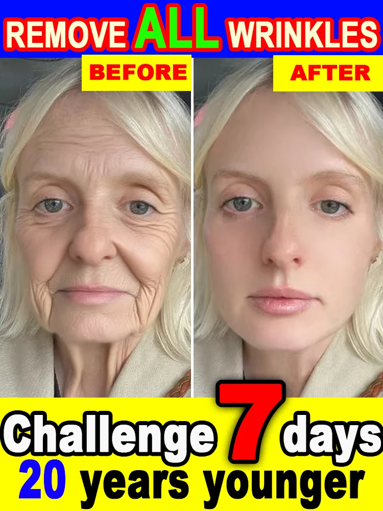 ไม่มีริ้วรอย อายุน้อยกว่า 20 ปี หน้าเต็มตัว