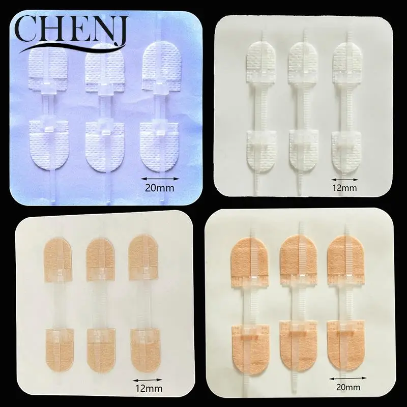 3 buah/set ikat ritsleting penutup luka Patch hemostatik Patch luka cepat menjahit ritsleting Band-Aid luar ruangan portabel