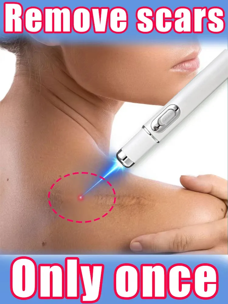 

2025 hot sale Blue light therapy Laser pen Scar Relief Easy Harmless Laser Pointer Highly efficient Tools