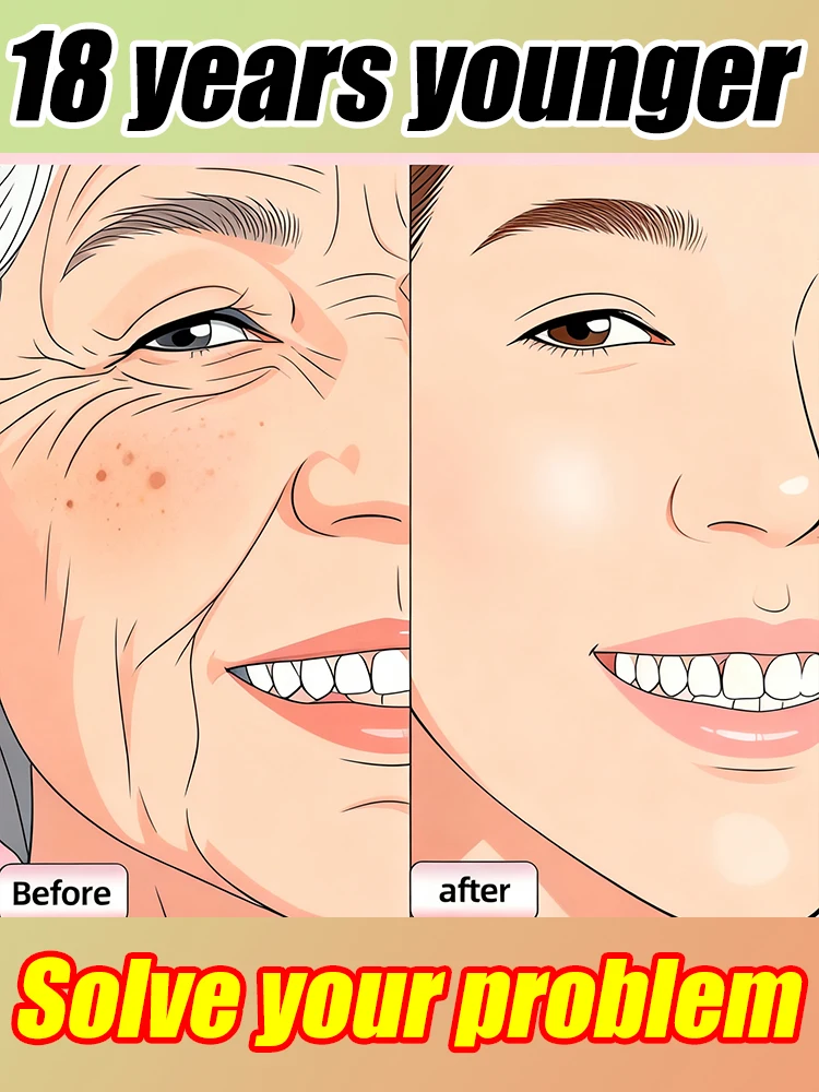 

решает морщины и не выглядит старым