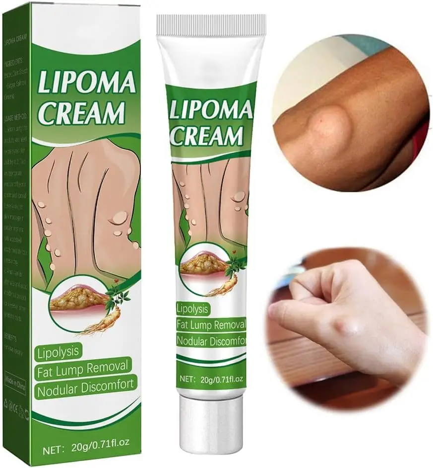 Lipoma salep menenangkan, Lumpfree, krim Anti bengkak kulit