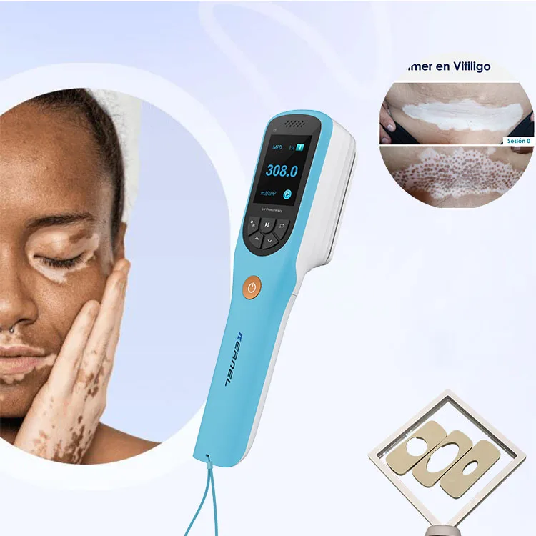 

Kernel CN-308B UV LED 308nm Excimer Targeted Phototherapy for Vitiligo Psoriasis Treatment 308 nm Excimer Laser Phototherapy