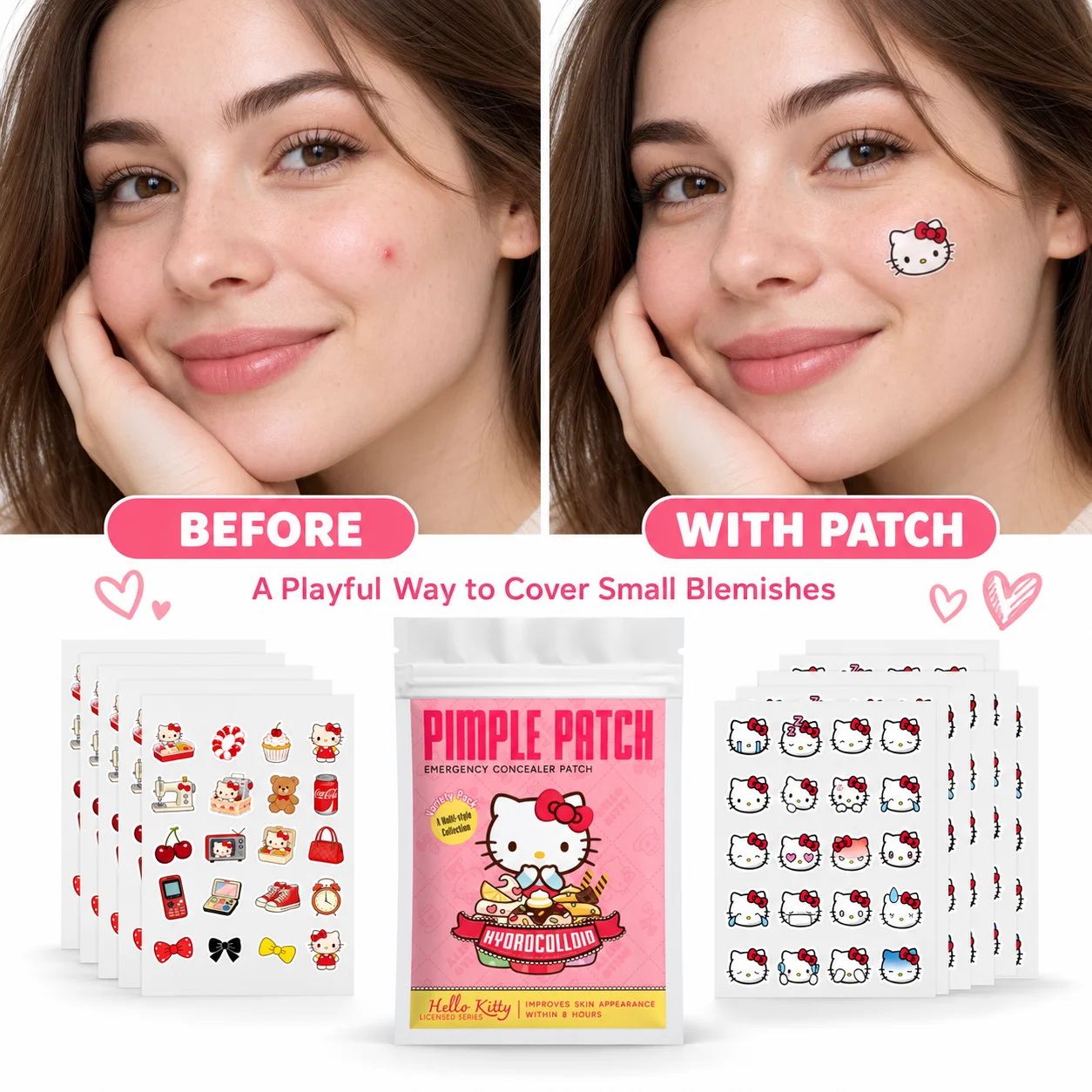 80/200pcs Cartoon Hello Kitty Hydrocolloid Patches, Invisible Concealer And -Removing Patches, Cute Design, Portable Packaging