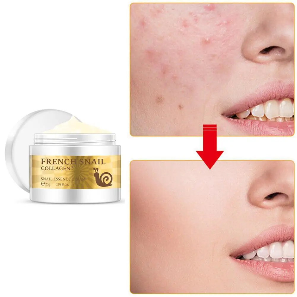 Schnecke Creme Hyaluronsäure Anti-Falten Anti-aging Gesichts Bleaching Tag Creme Kollagen Feuchtigkeitscreme Nähren Korea Gesicht Haut pflege