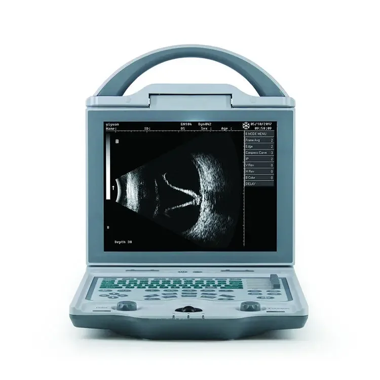 Ysenmed Portable Ophthalmic A/b Ultrasound Scanner Eye Ultrasound Scanner for Hospital