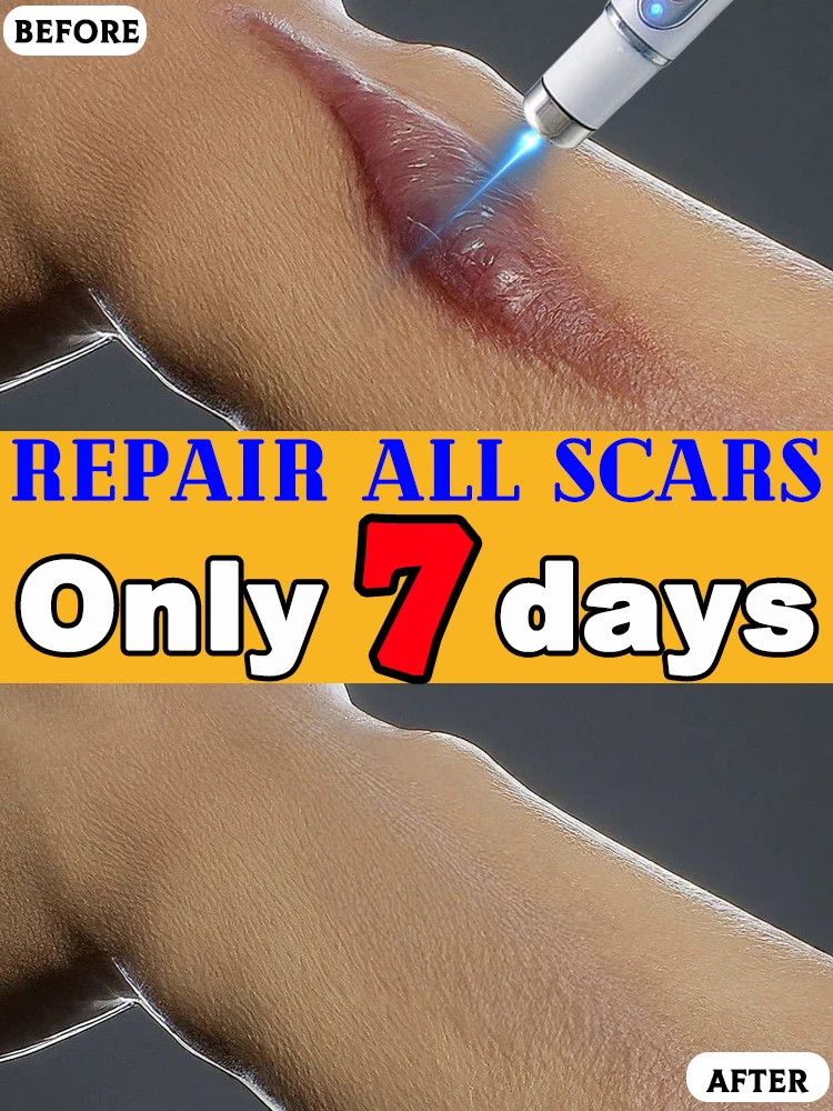 傷跡を治療し、美しくなり、自信を取り戻しましょう