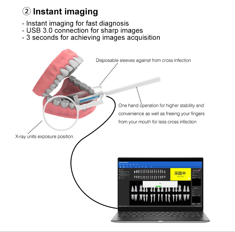 Tragbarer Dental-Röntgensensor Hochfrequenz-Rx Digitales Intraorales Digitalsystem Bildgebungs-Dentalwerkzeug Superschneller Sensor VVDental – Detail 5