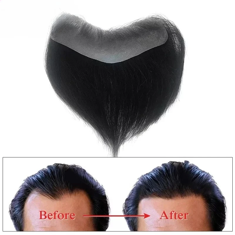 Category image: Men’s Wig&toupee (For White)