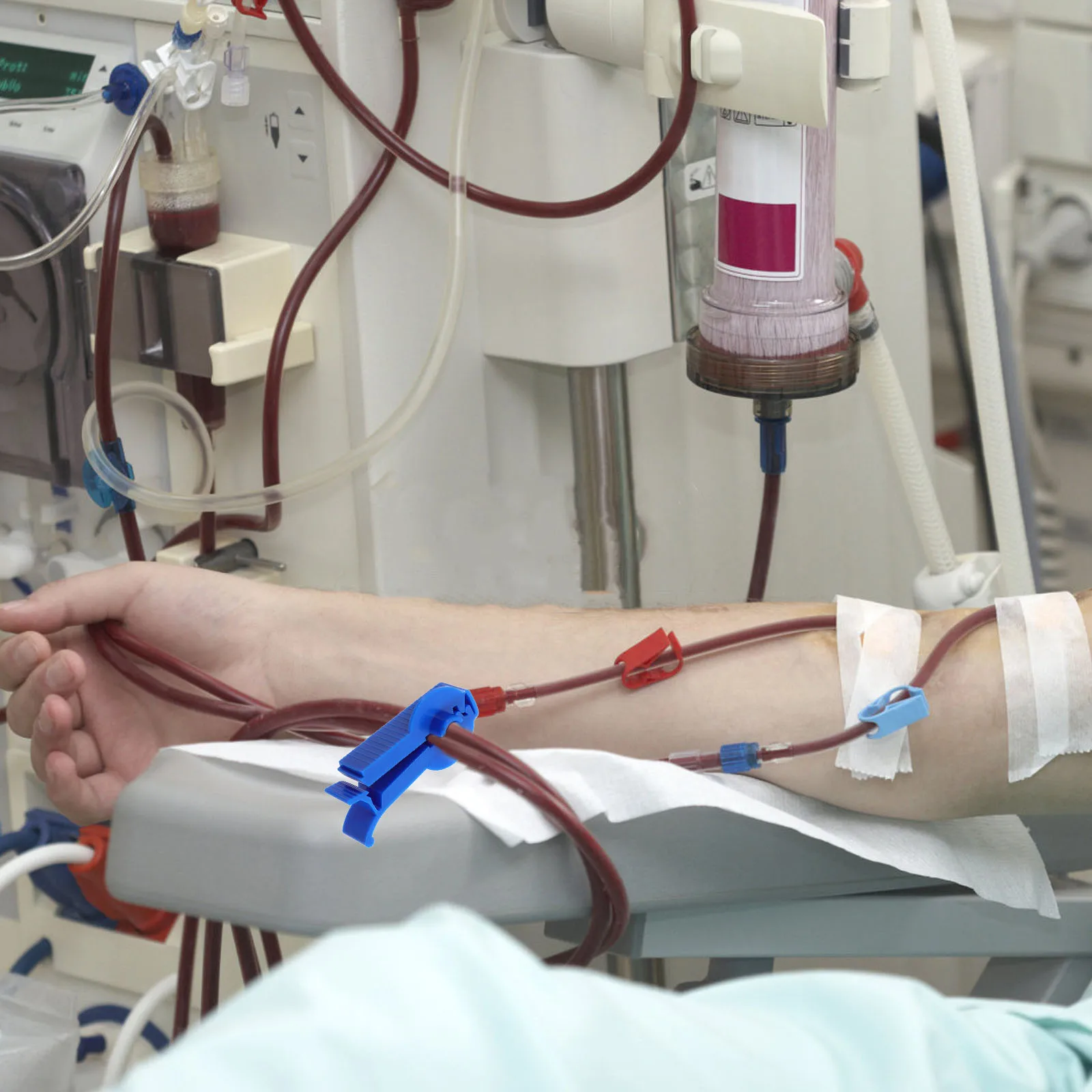 6Pcs Peritoneal Dialysis Fixator Peritoneal Pipeline Clips Peritoneal Dialysis Tubing Clips for Patients