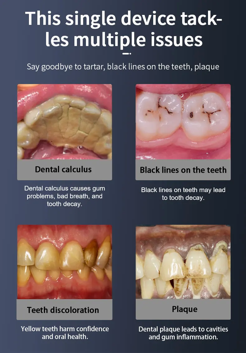 IP67 Sonic очиститель зубов электрический стоматологический скалер средство для удаления зубного налета удаление зубного камня инструмент для чистки зубов
