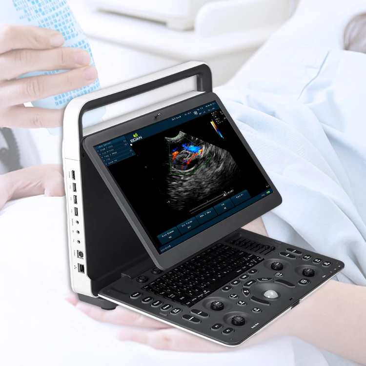 sonoscape e1 exp expert machine 4d ultrasound