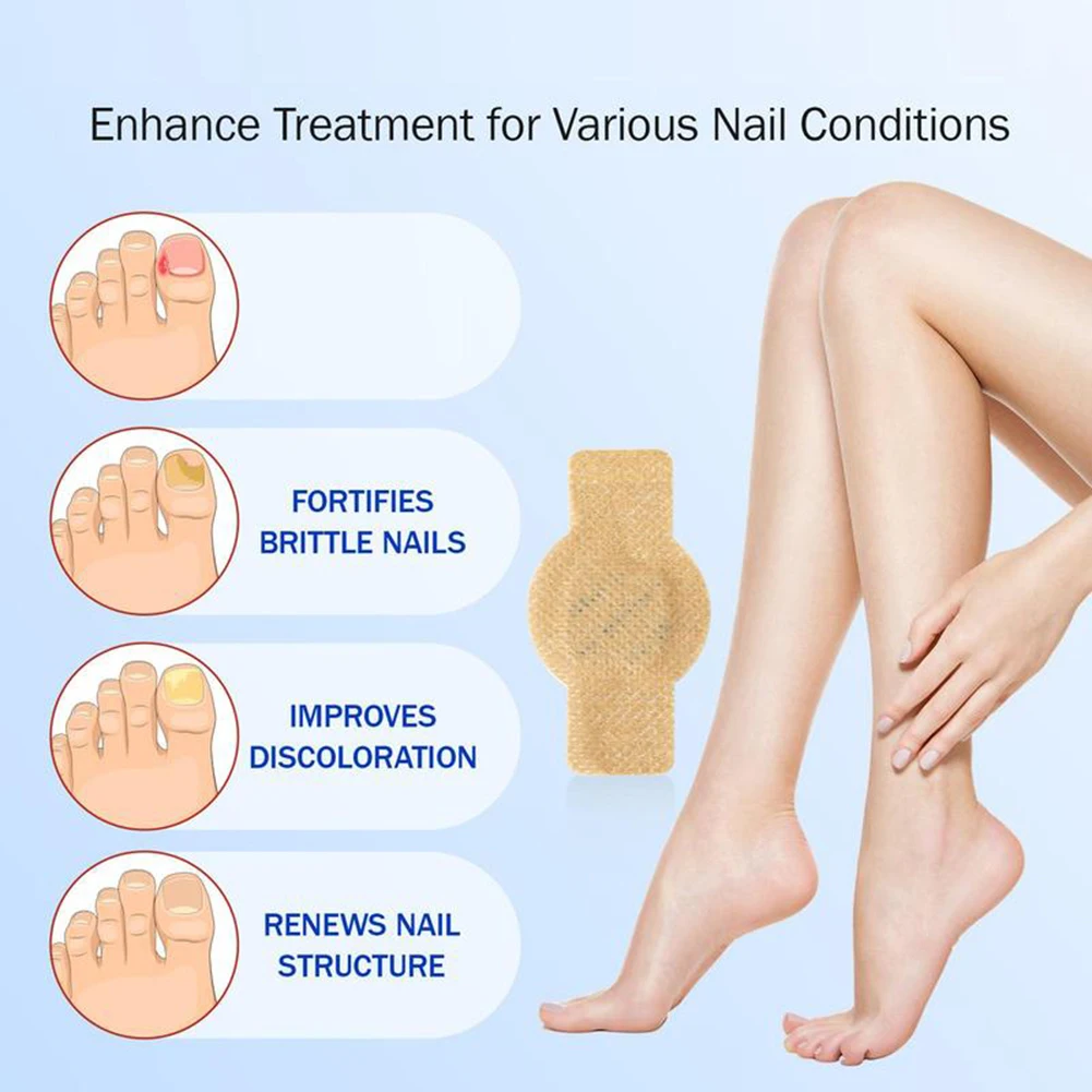 Nichtinteritation von Pilznagel-Patch stärkt die feuchtigkeitsspezifische Anti-Zehennagel-Fungus-Behandlungsaufkleber Schnellabsorption Rehabilitation Patch