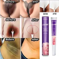 Private body whitening cream armpit buttock nipple private area pink essence to remove melanin brighten beauty care Melanin remo