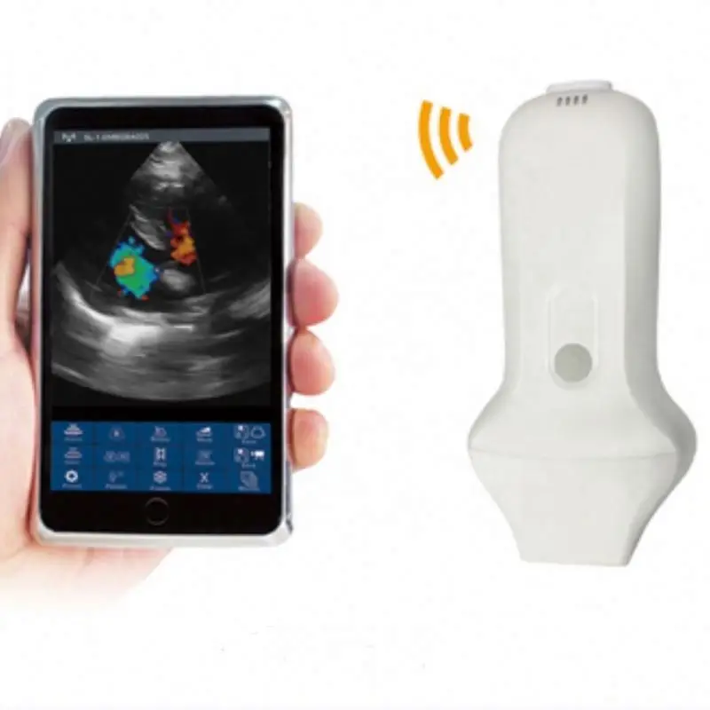 

Doppler Portable Wifi Ultrasound Wireless Probe/ Handheld Doppler Ultrasound Phased Array