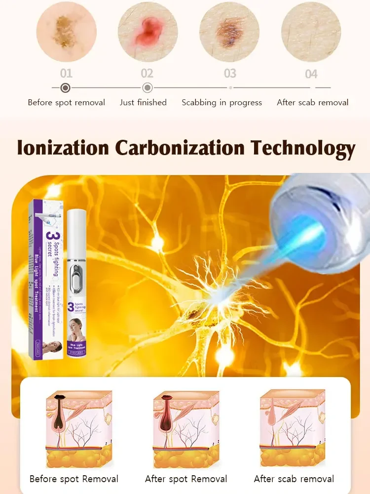 Instrument de beaute domestique pour rajeunissement et eclaircissement de la peau, laser facial pour eclaircir les taches brunes