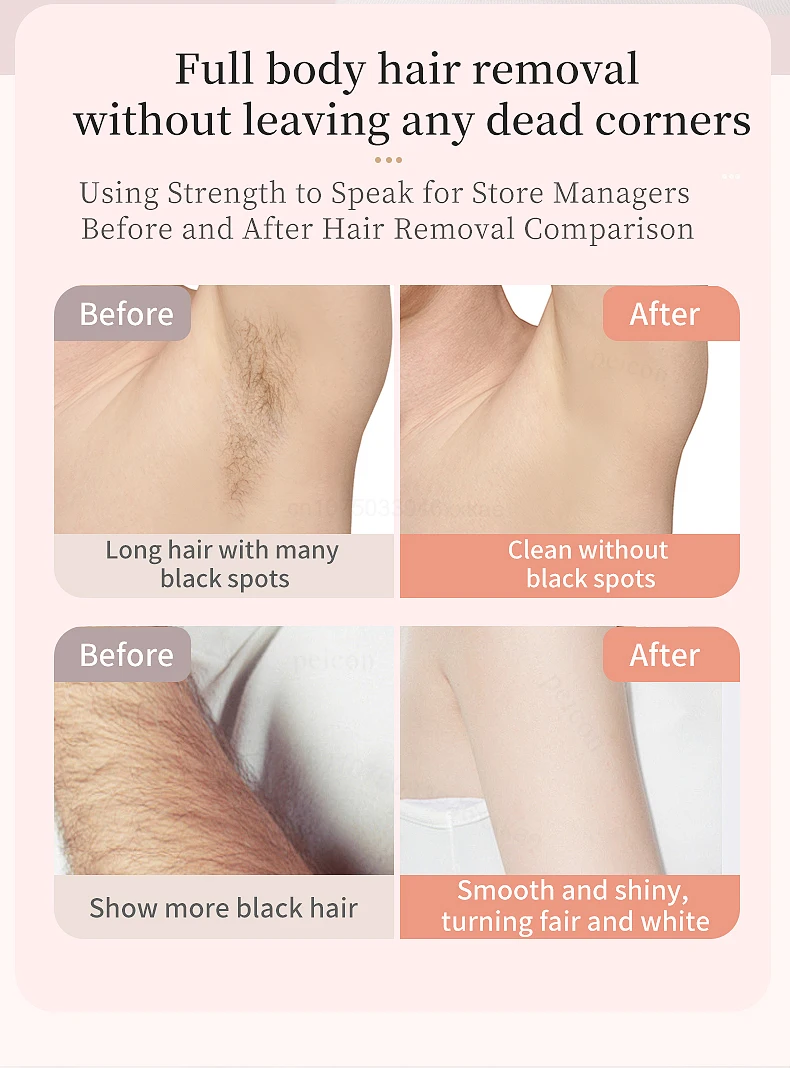 Veloura Smooth Body Trimmer detail