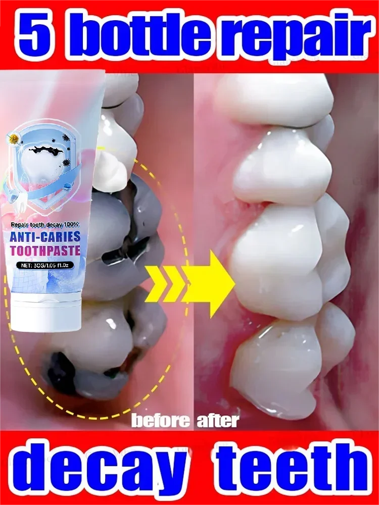 

Содержит пробиотики для ремонта карниза и очистки зубов2025