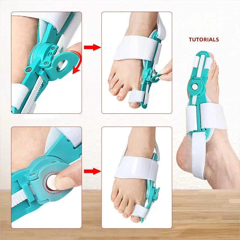 Corrector de Hallux Valgus, separadores de dedos del pie para juanetes, separador Haluksy del dedo del pie, Corrector de juanete, separador de dedos Halux Valgus
