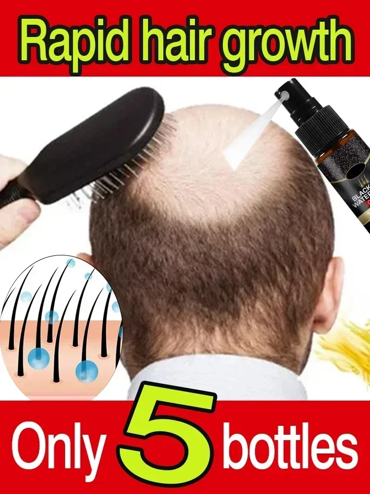 

Black Rice Hair Growth Spray Repairs Damage Restore Soft Hair For All Hair Types Fast Treatment Prevent Thinning Dry Repair