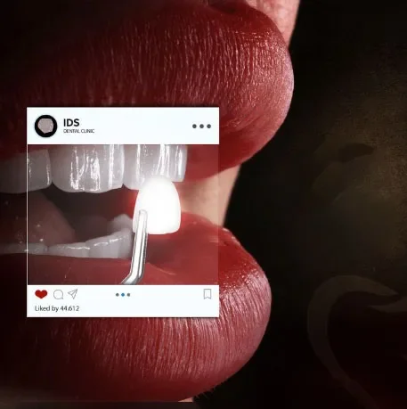 معجون أسنان مضاد للتجويف، إعادة تعيد الأسنان، إصلاح المينا، تعزيز، حماية التسوس، أسنان الأسنان #2