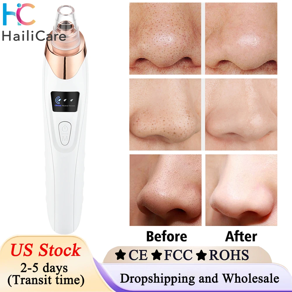 Elektryczny odkurzacz do wągrów z akumulatorem, silny odsysacz do czarnych kropek, porów i trądziku, do twarzy i nosa, dostępny w USA.