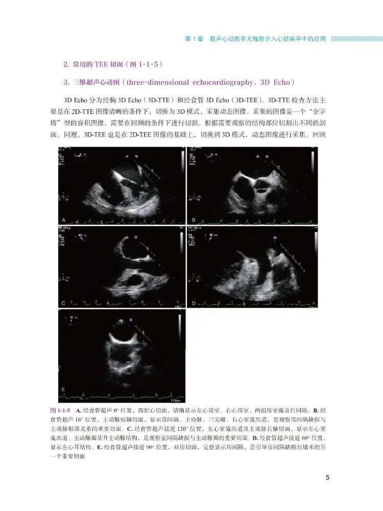 Book-Winshare Radiation Free Interventional Cardiology