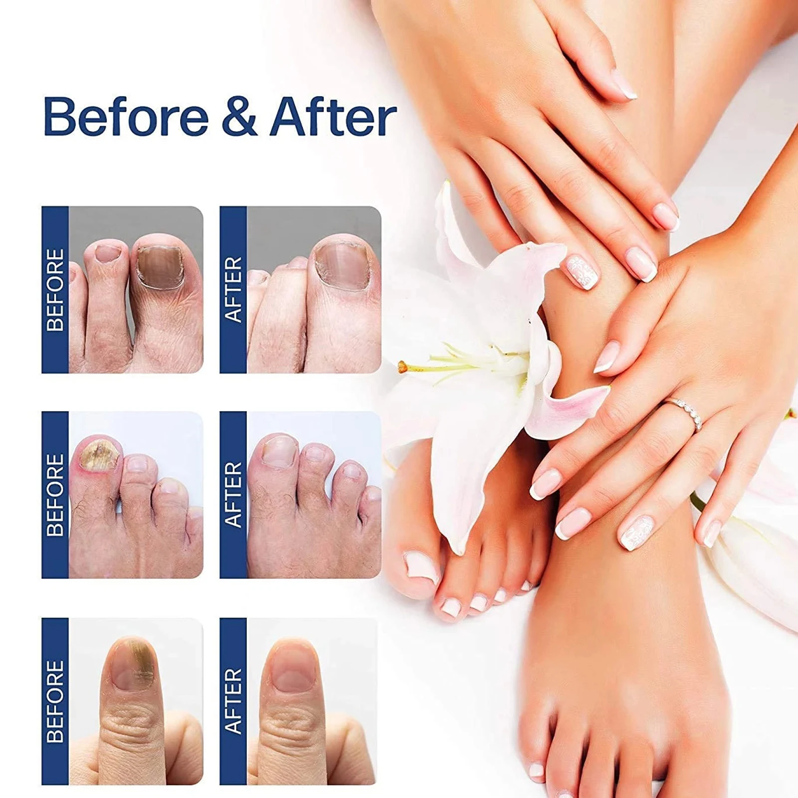 20ml nails repair Essence liquid Renew Damaged, Broken, Cracked & Discolored Nails for Damaged Discolored Yellow Nails