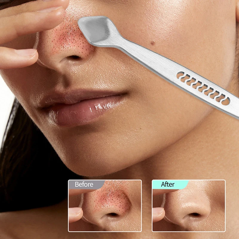 Rvs Mee-eter schop Dubbele Hoofd Remover Tool Puistje Acne Talg Verwijderen Gezicht Smet Extractor Gereedschap Gezicht Huidverzorging