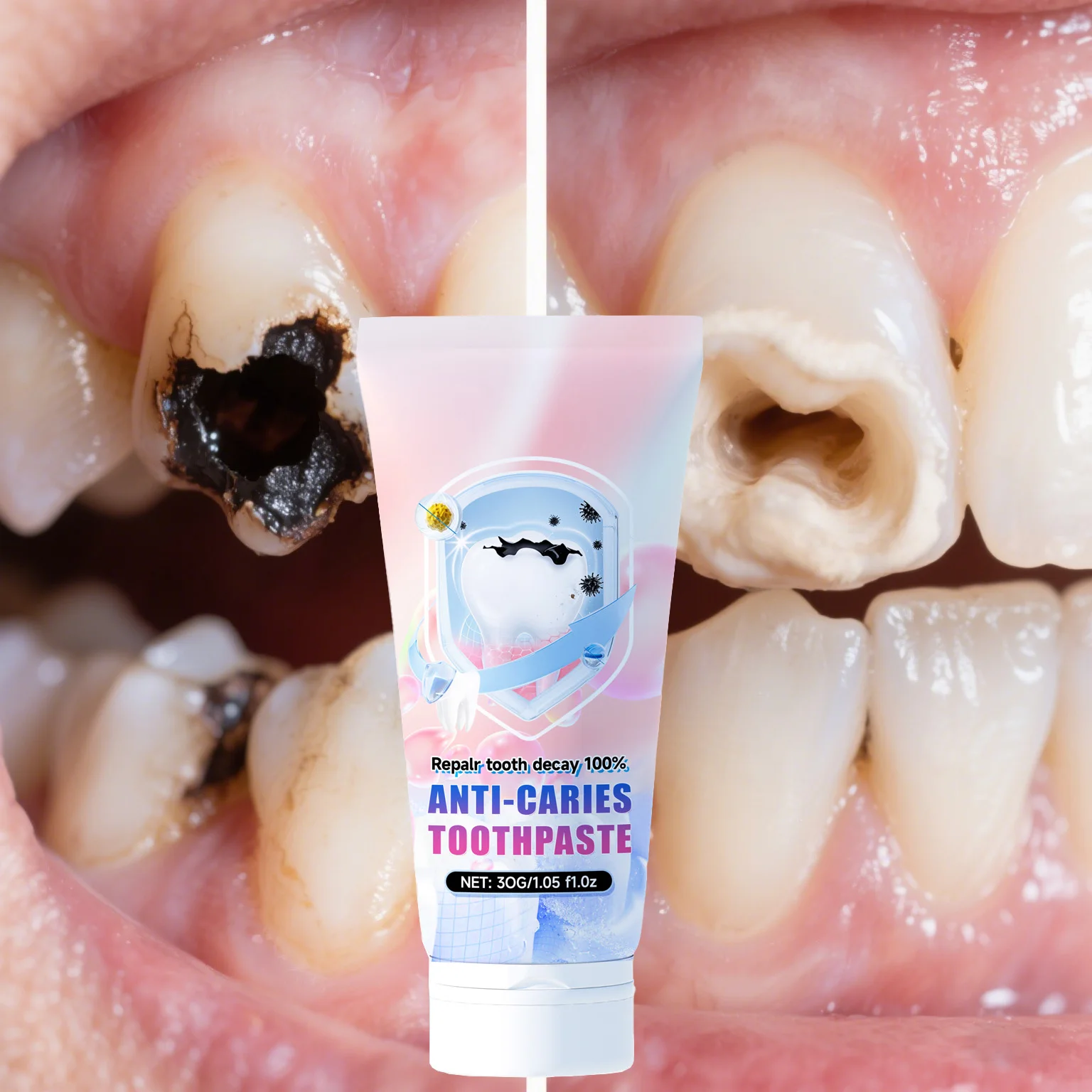 امنح لك سنًا صحيًا #1