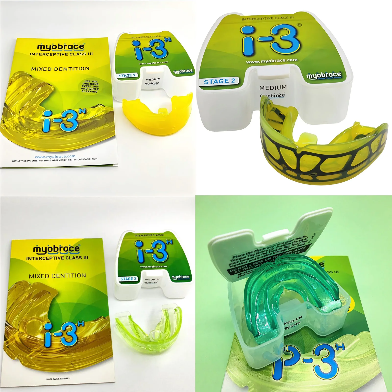 

Ортодонтический тренажер для зубов Myobrace I-3N для детей 5-8 лет: стоматологическое устройство для коррекции смешанной зубной формулы и исправления прикуса