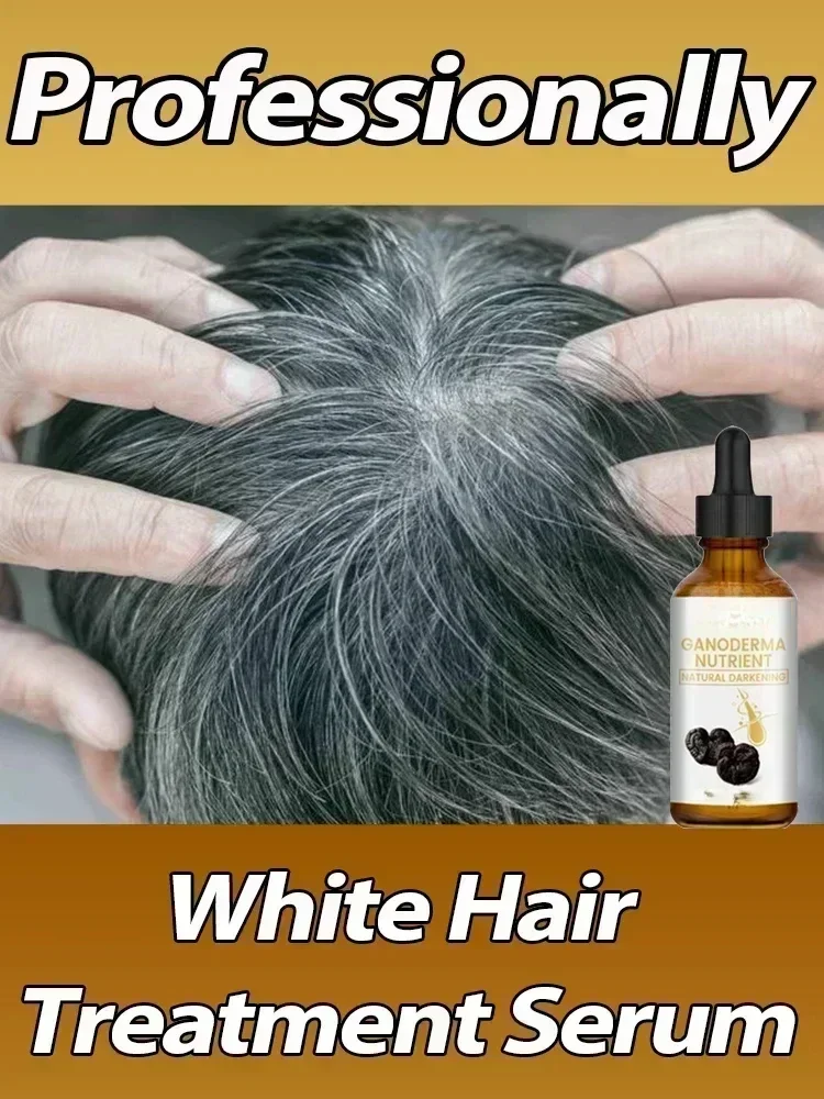 White Hair Killer, permanently removes white hair, restores natural hair color in 7 days