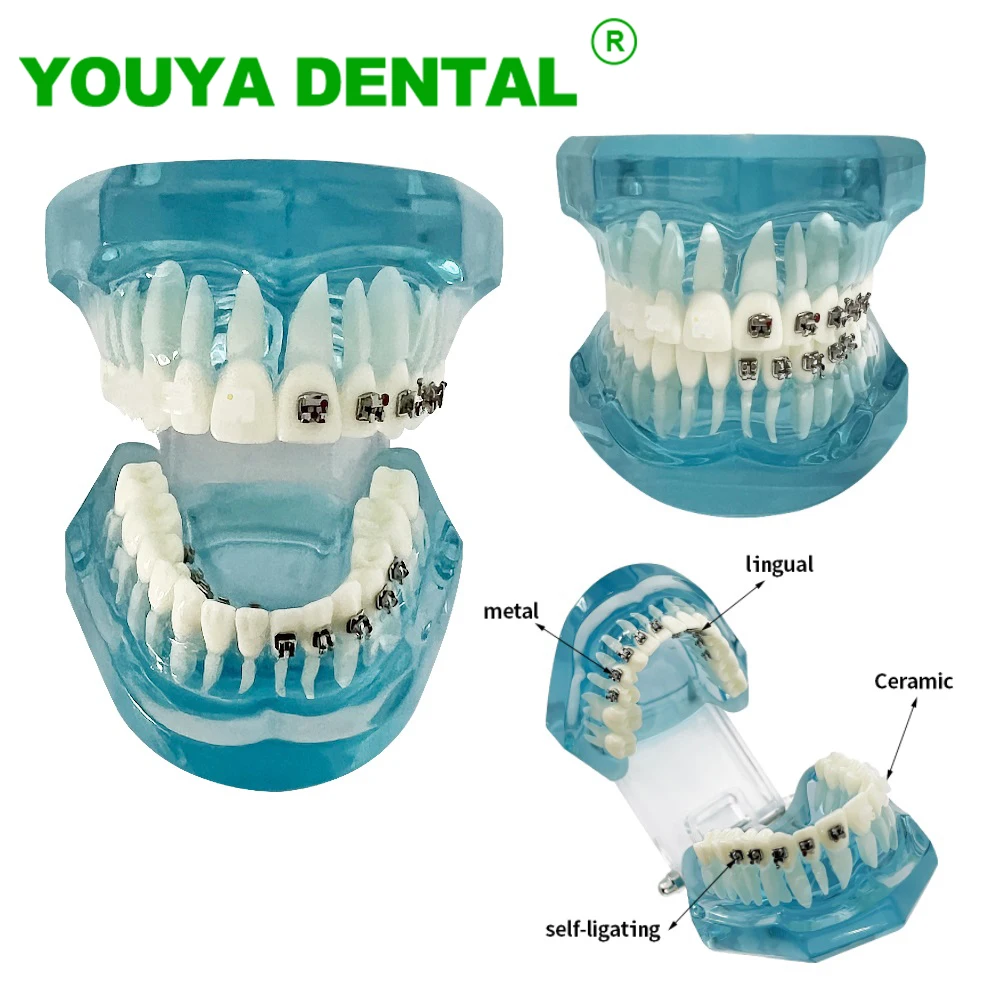 

Dental Orthodontic Model With 4 Type Bracket Braces Typodont Teeth Model Dentistry Teach Study Demonstration For Patient Student