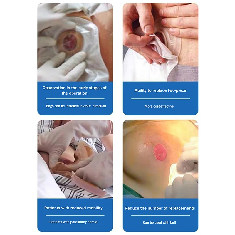 Disposable Ostomy Bags with Carbon Lining - Leakproof Barriers + Baseplates (Safe Daily Use for Stoma Care)