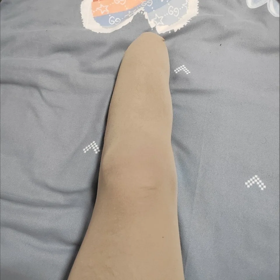 Stockings for stumps, stockings for calf and thigh prostheses, stockings for prosthetic limbs, stockings specifically for stumps